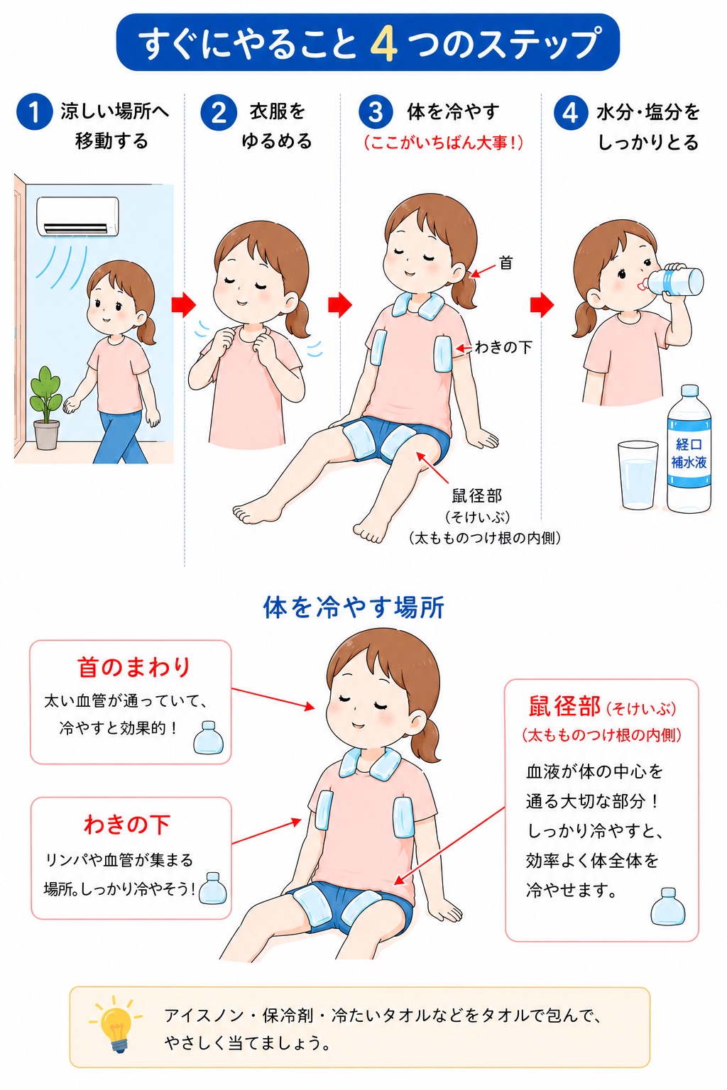 熱中症で冷やす場所はどこ？おでこは無意味？命救う太い血管冷却法