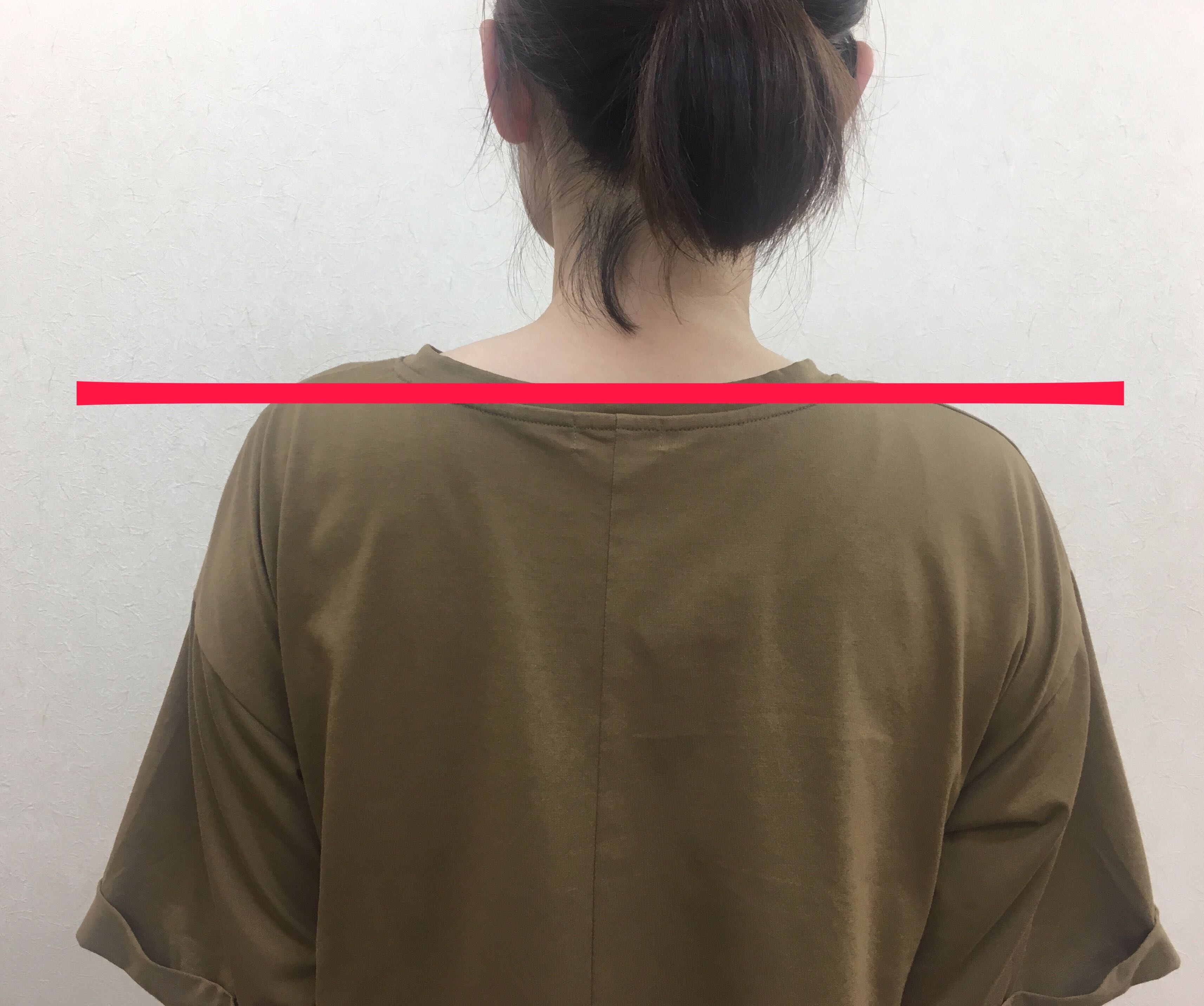 肩の高さが違う原因と治し方｜骨盤の歪みや側弯症のセルフチェック