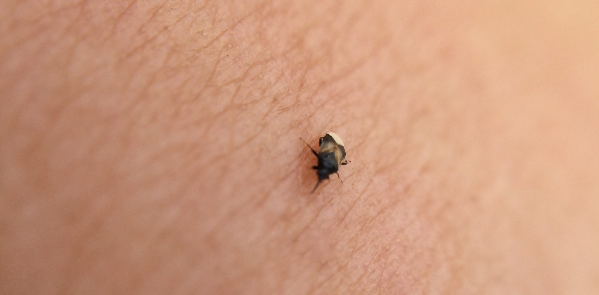 Tiny Black Bugs on My Skin