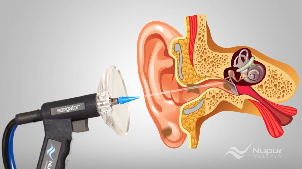 London Microsuction Ear Wax Removal London Nw1
