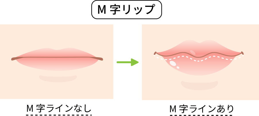 M字はげにツーブロックは危険？失敗する理由と2026年最新の隠し方