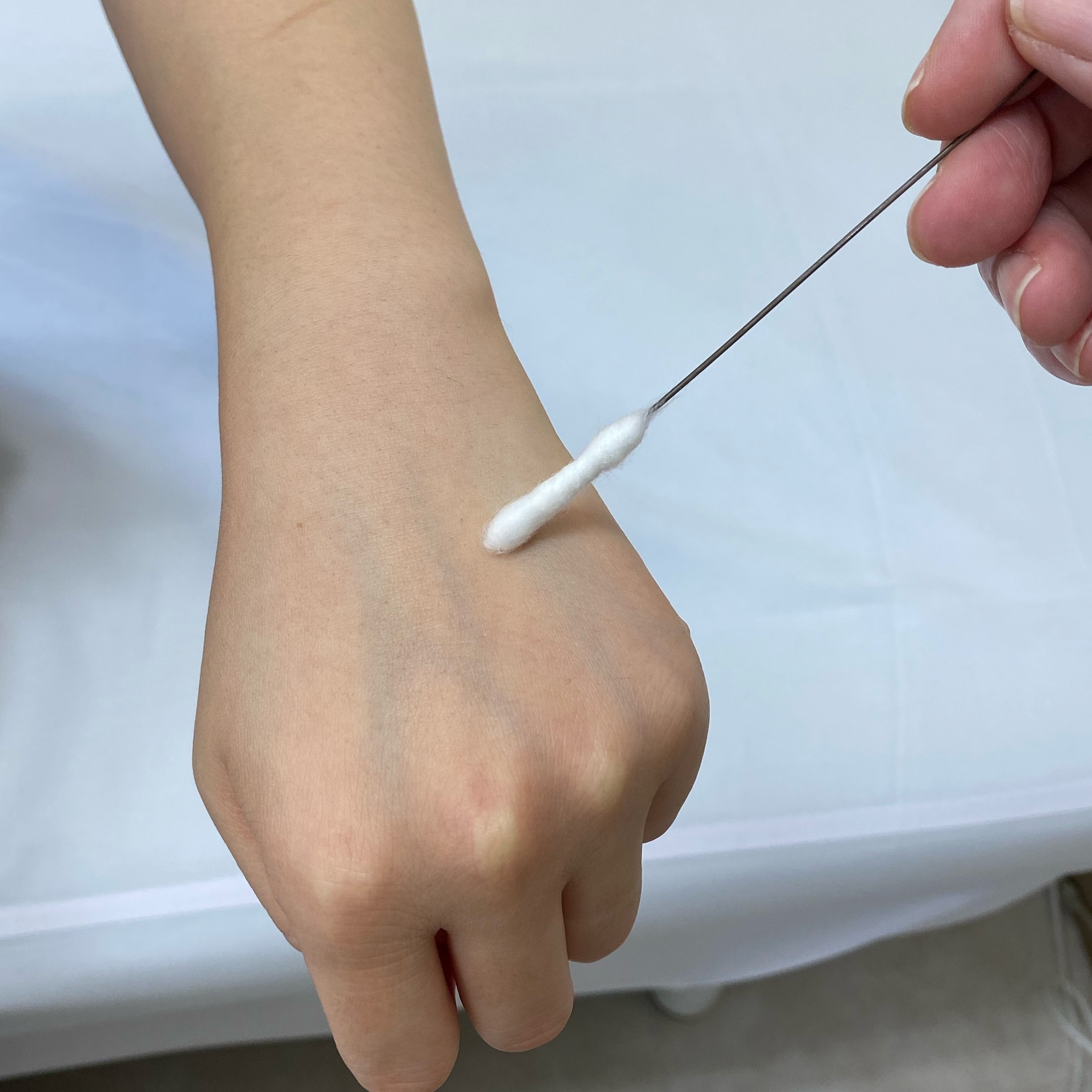 イボの液体窒素はなぜ激痛で長引く？治療回数の目安と水ぶくれ対処法