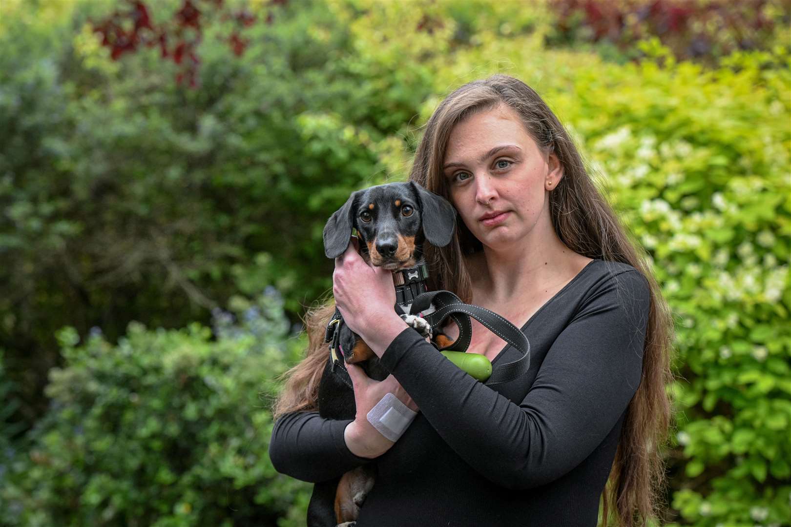 Miniature Dachshund Socks Saved Owner from Escaping Dog in Cambridge