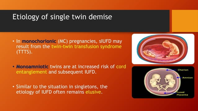 What Happens When One Twin Dies in the Womb