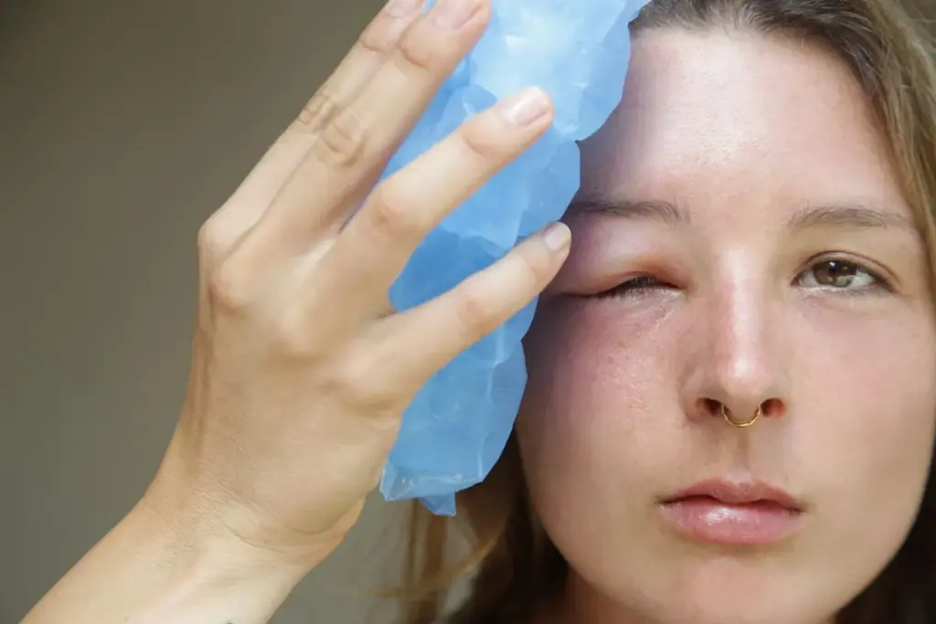How to Reduce Swelling Eyes After Crying