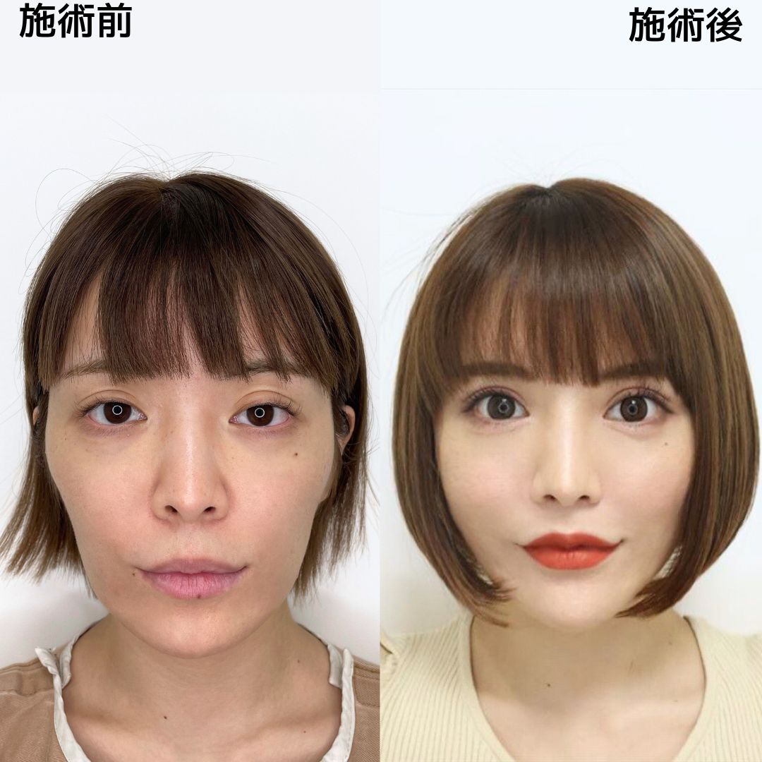 妹尾ユウカの現在と炎上理由・結婚の噂や経歴プロフィール徹底検証