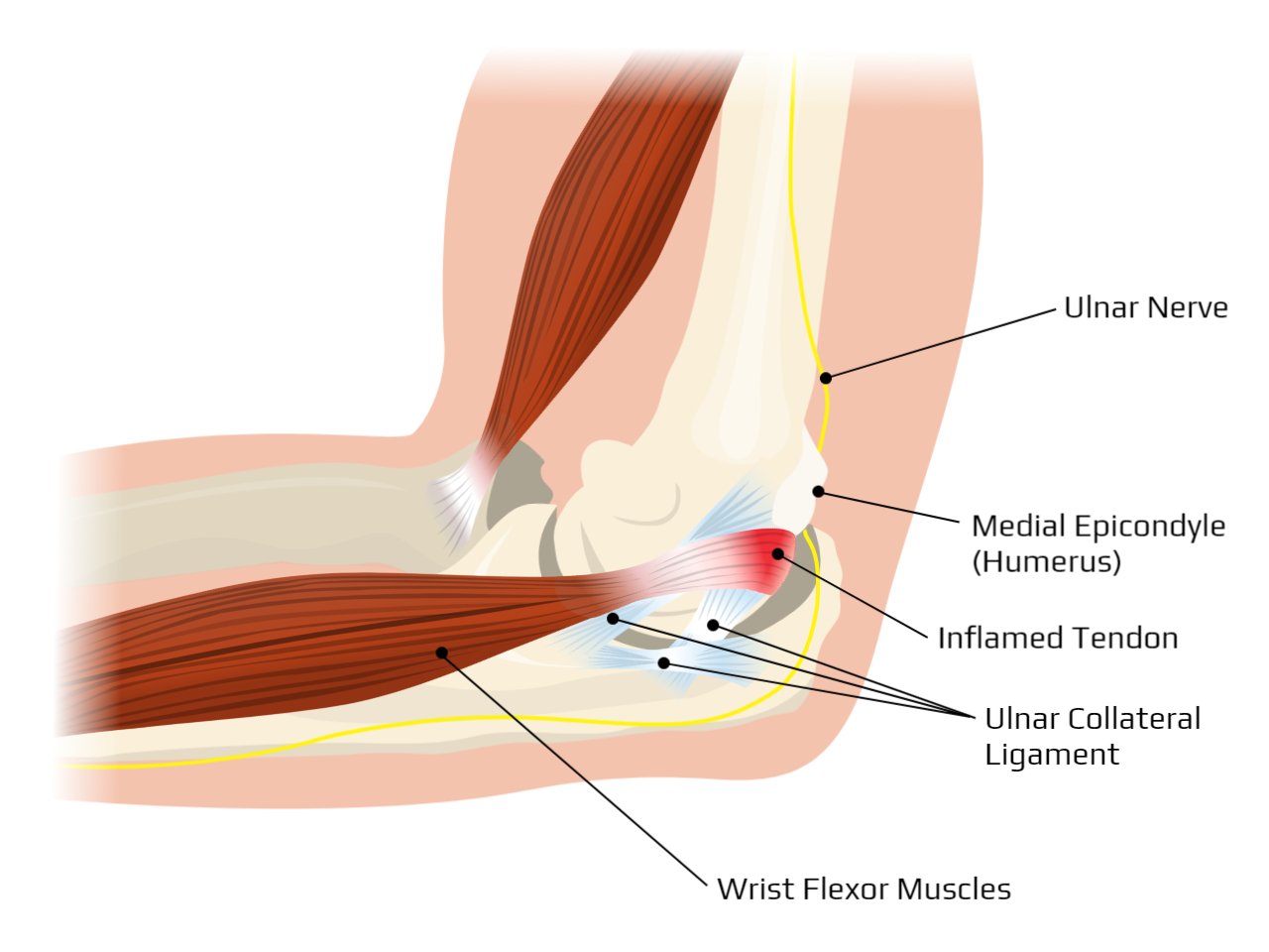 Burning Sensation Inside Elbow