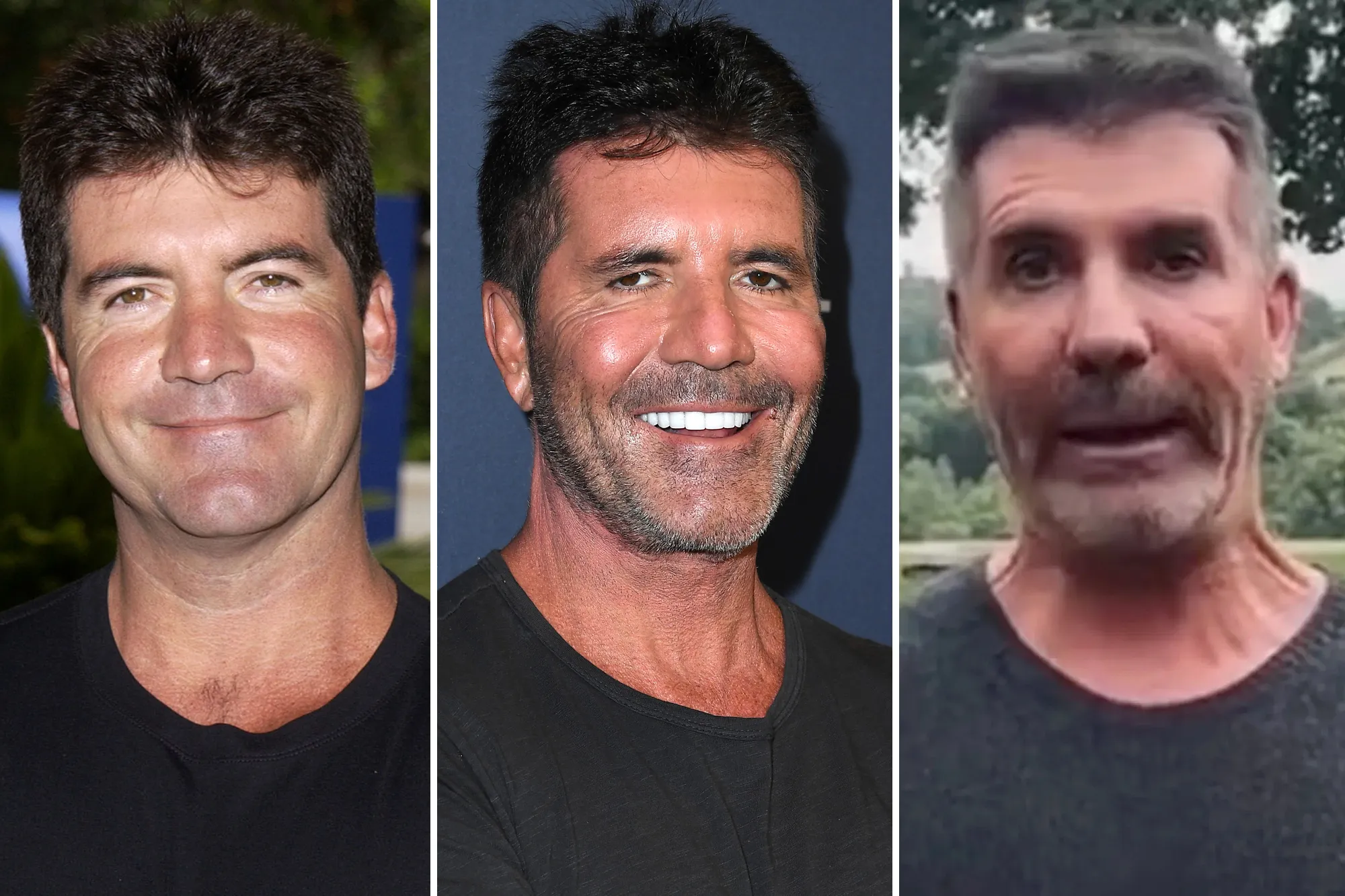 What's Happened to Simon Cowells Face