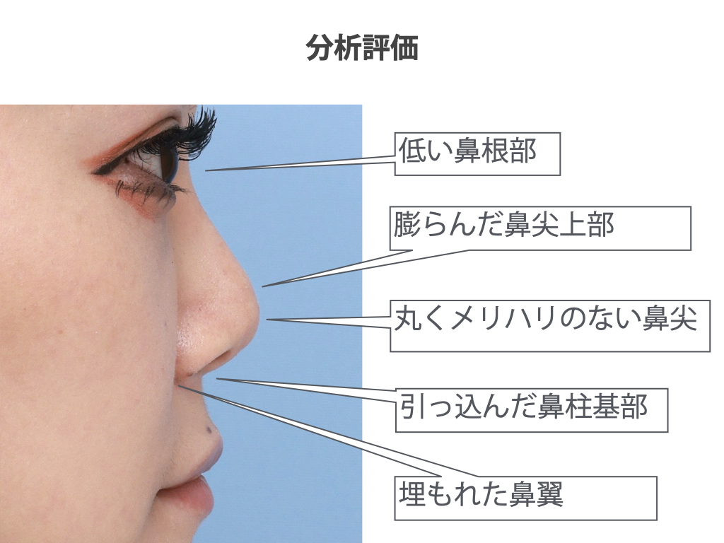 鼻が低くても圧倒的に可愛い理由とは？美人見えメイク術と骨格の真実