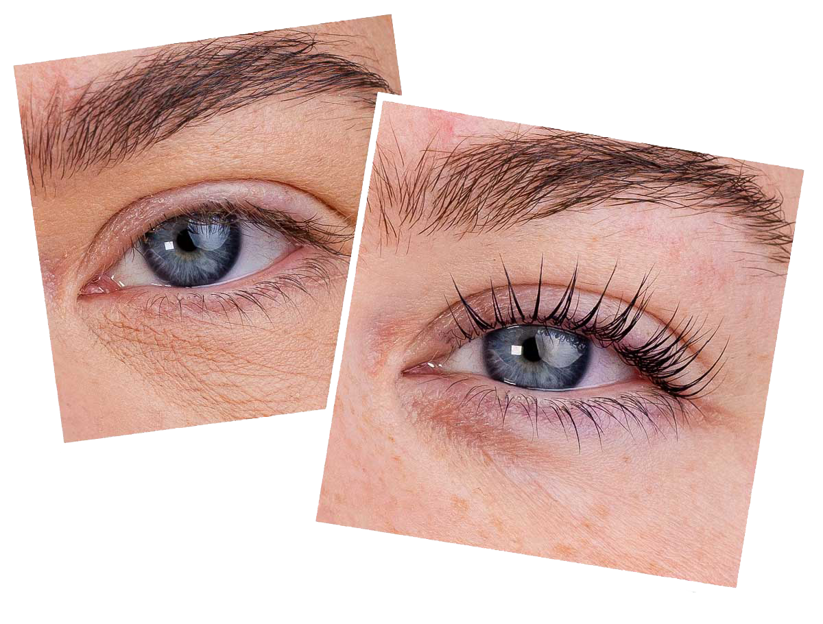What Is an Lvl Lash Lift