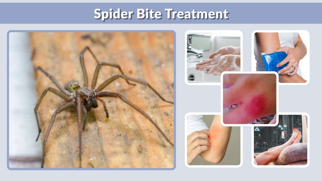 How to Remove Spider Bite