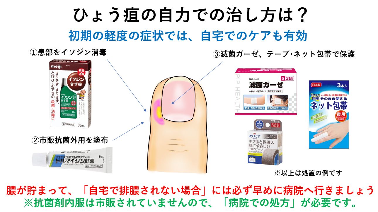 爪周囲炎の市販薬おすすめ比較！ズキズキ痛む腫れに効く軟膏の選び方