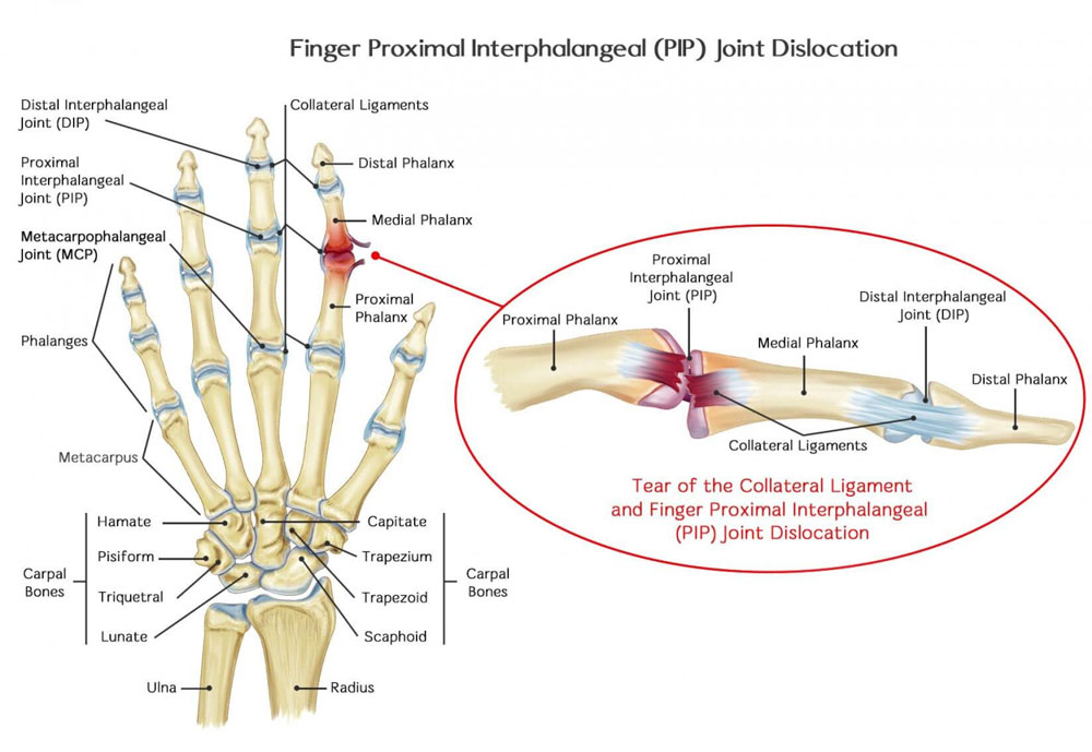 Pip Payments Muscle or Joint Conditions