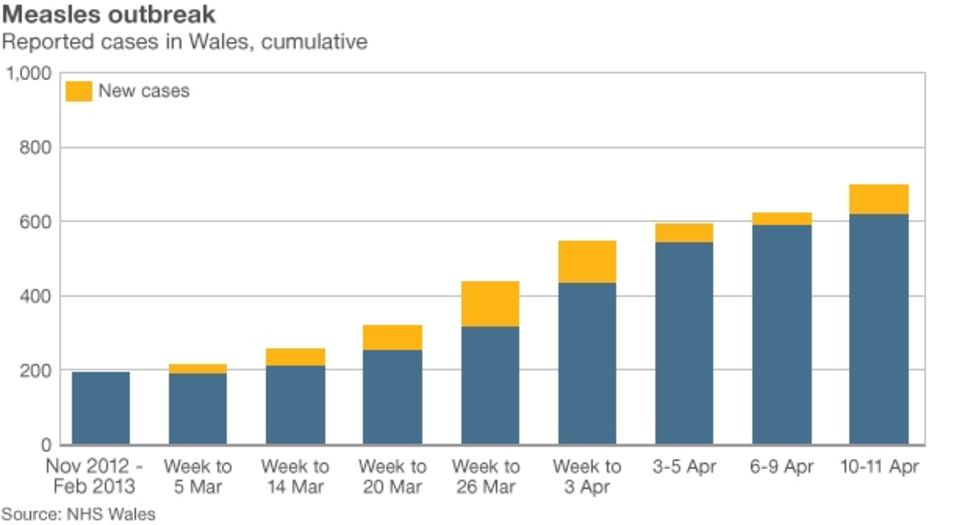Case Fatality Rate of Measles