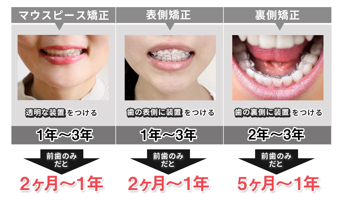 マウスピースで顔は変わる？輪郭変化の真相と後悔しない全知識