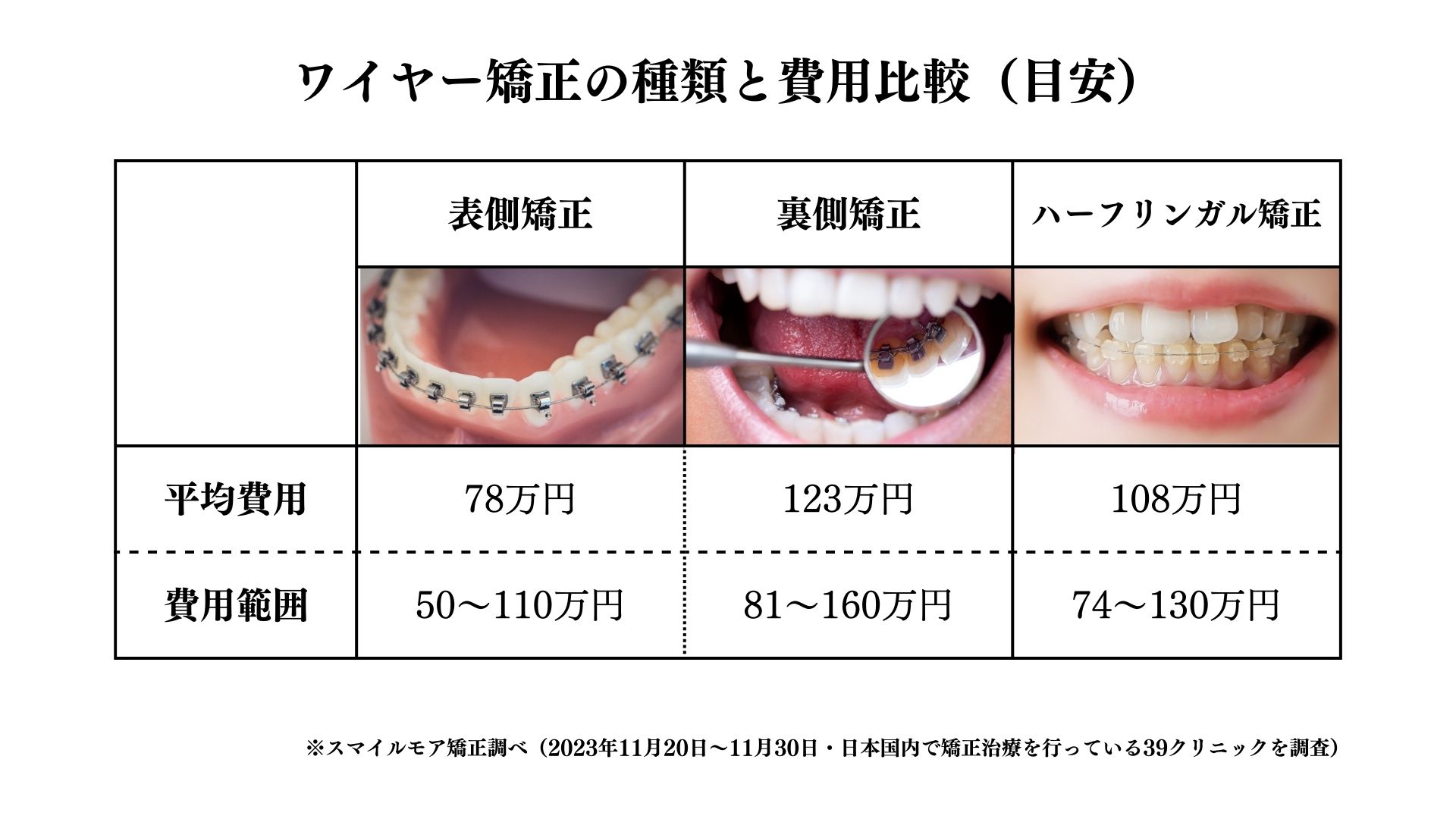 芸能人の歯列矯正ビフォーアフター徹底検証！顔の変化と垢抜けの真相