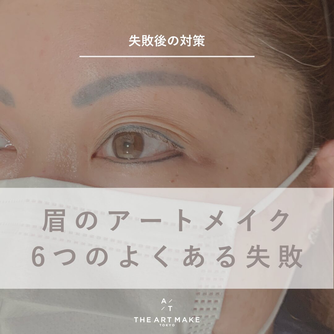 眉アートメイク失敗の真相と後悔理由｜除去修正費用と回避策【2026】