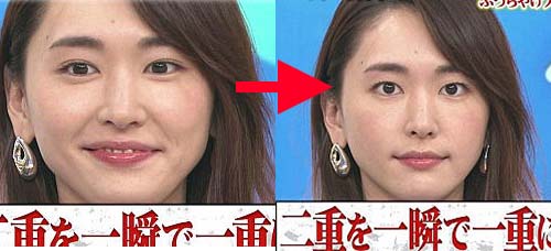 新垣結衣の鼻に整形疑惑？昔の写真と現在を比較検証して見えた真実