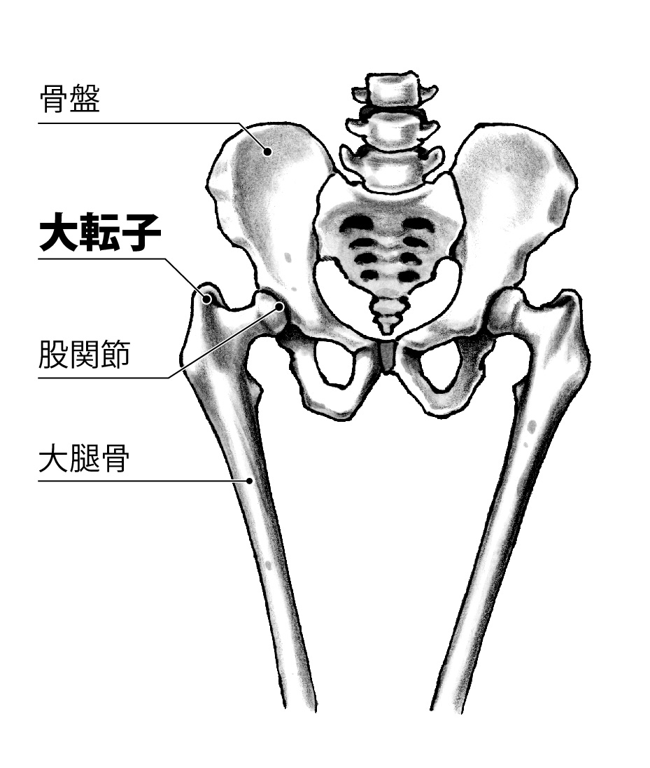 大転子部とはどこ？太もも外側の痛みと出っ張りの真相【2026最新】
