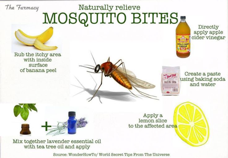 Ways to Make Mosquito Bites Stop Itching