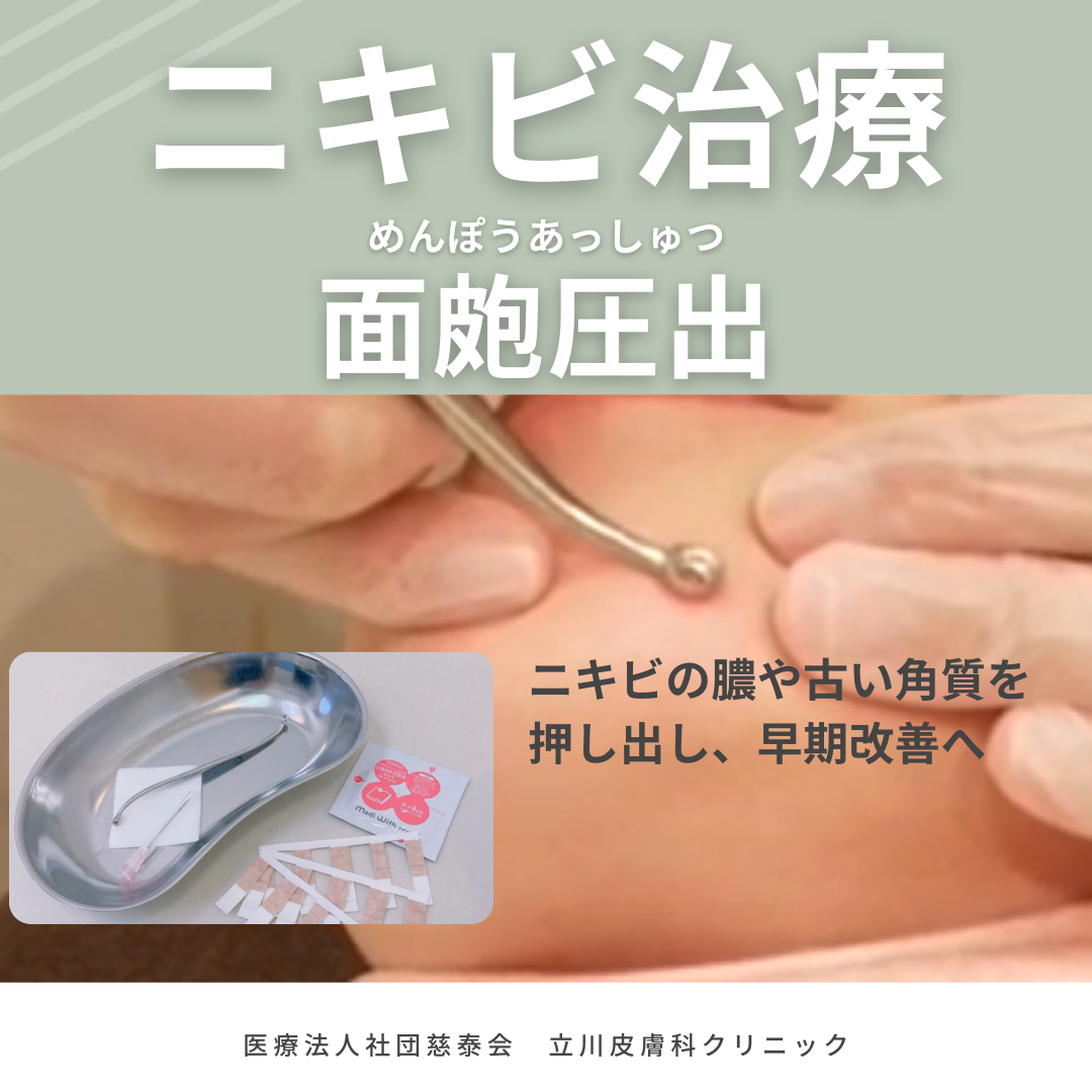 ニキビ圧出で跡は残る？皮膚科の費用や保険適用と痛みの真相