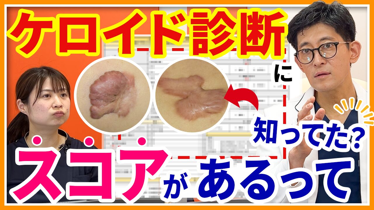 ケロイド体質の見分け方と肥厚性瘢痕の違い｜セルフ診断と最新治療法