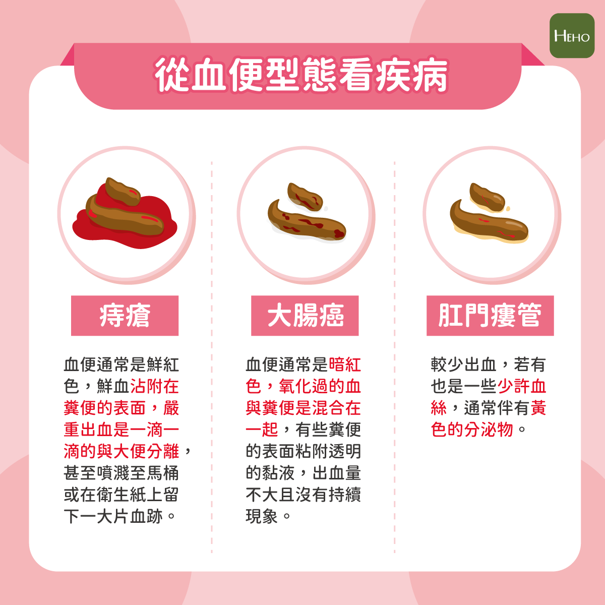 便の表面に血がついた時の原因は？痔と大腸がんの見分け方と受診目安