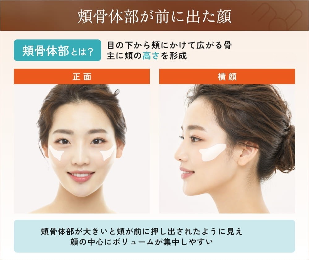頬骨が横に出るのは骨格だけじゃない？自力改善の真相と髪型メイク術