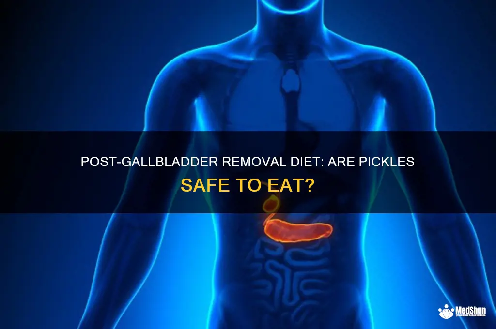 Can I Eat Pickles After Gallbladder Removal