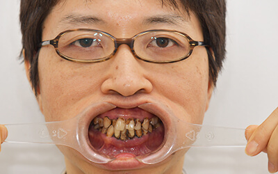 【インスタ画像】 歯 が ボロボロ 芸能人 最新熱愛噂まとめ #864