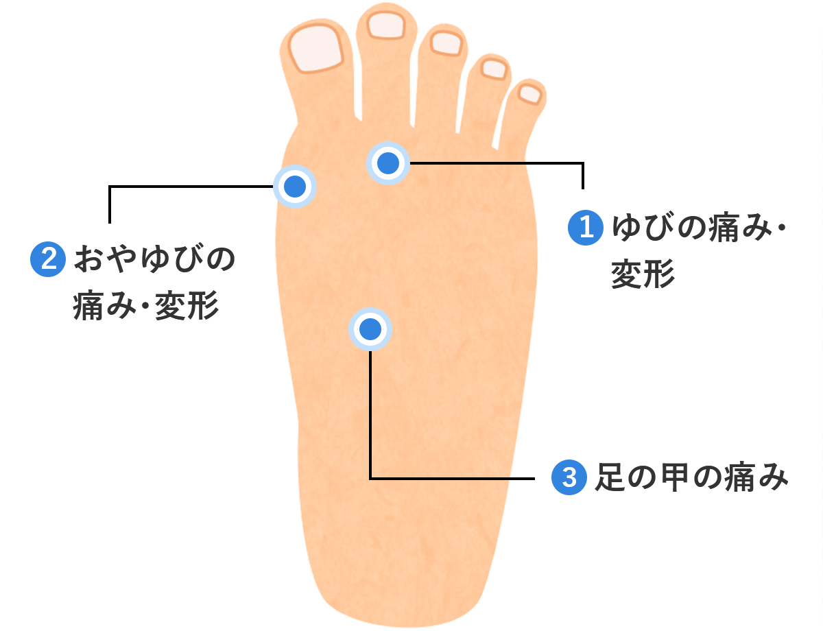 足が痛い原因と受診の目安は？部位別病気リスクと放置厳禁サイン