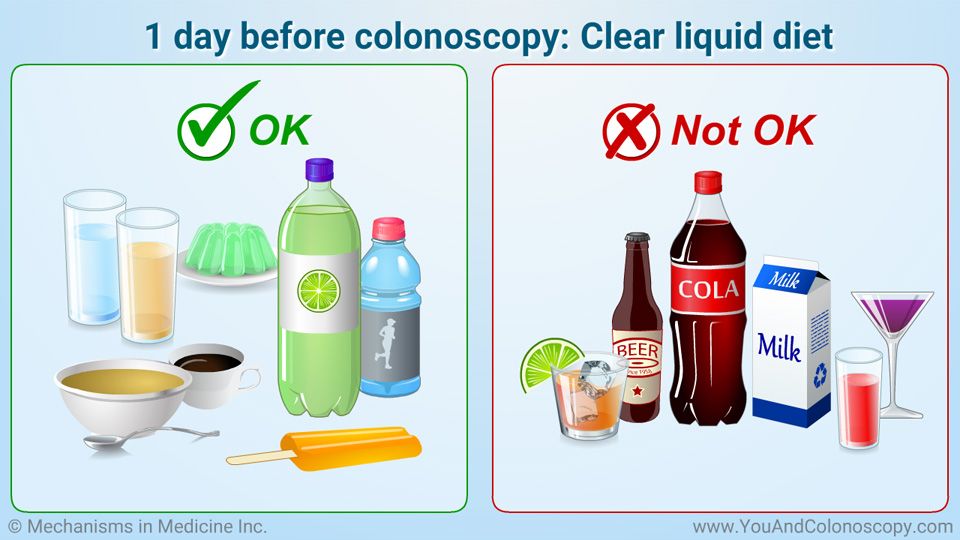 Is Jello a Clear Liquid Before Surgery