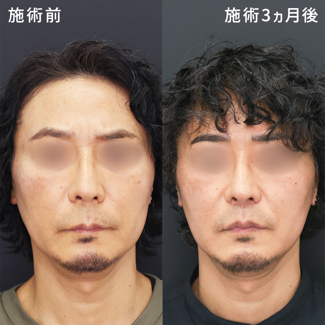 人中が長いイケメンの魅力解剖！黄金比を超越する色気の秘密と特徴
