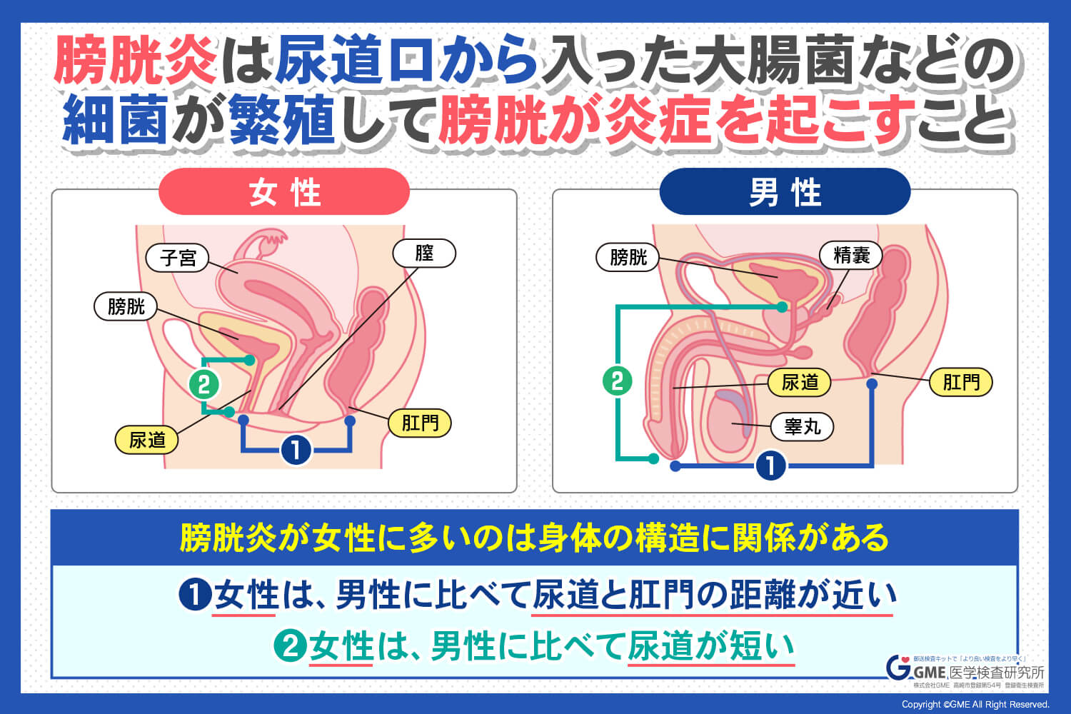 女性の膀胱炎はなぜ繰り返す？排尿痛の放置リスクと正しい受診目安