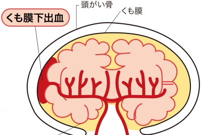 【インスタ画像】 星野 源 くも膜 下 出血 最新ライブ＆イベント情報 #779