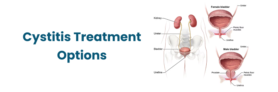 What Happens If a Man Take Cystitis Relief