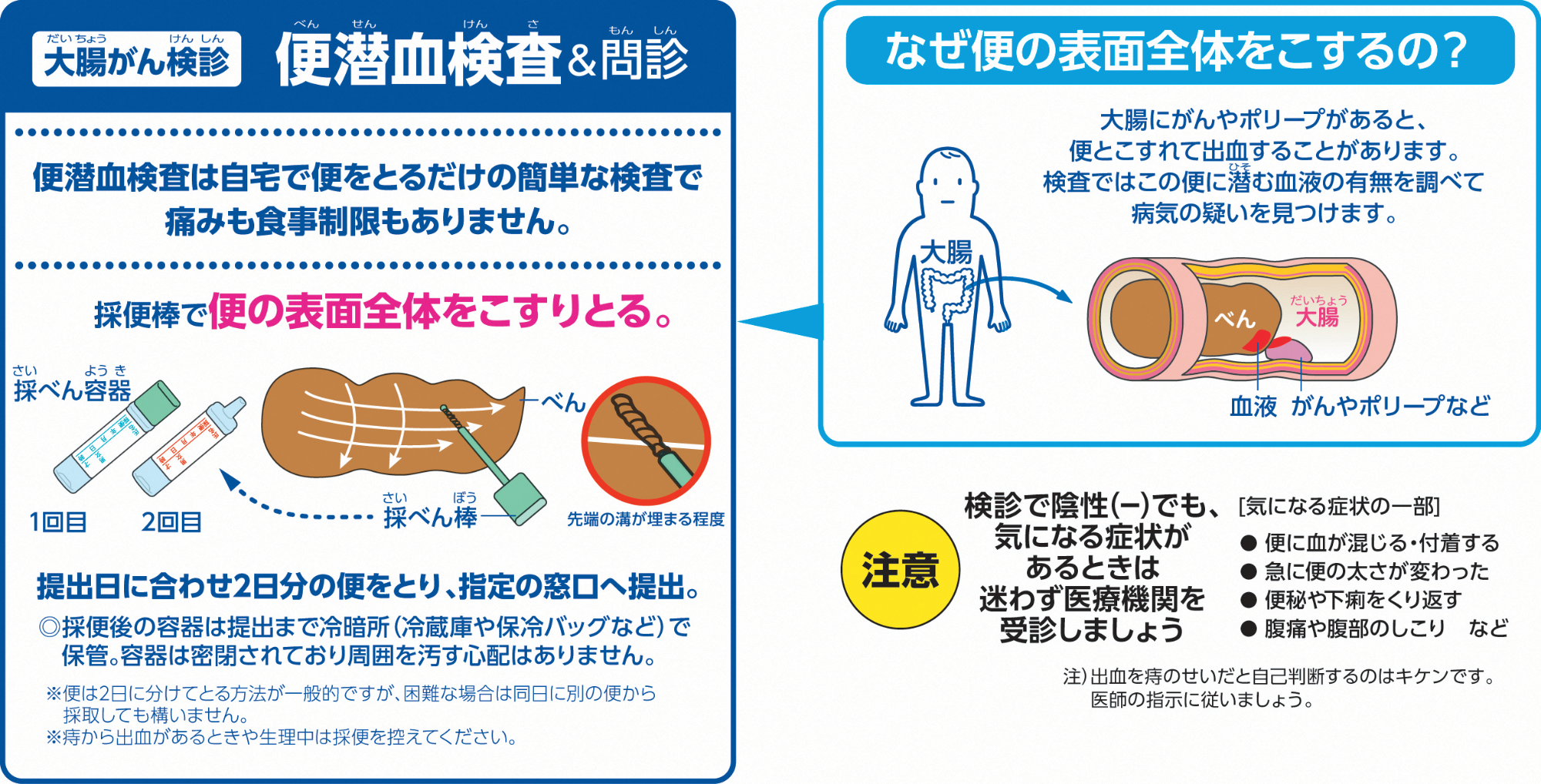大腸がん検便で陽性？痔との違いや確率と内視鏡検査の真実【2026】