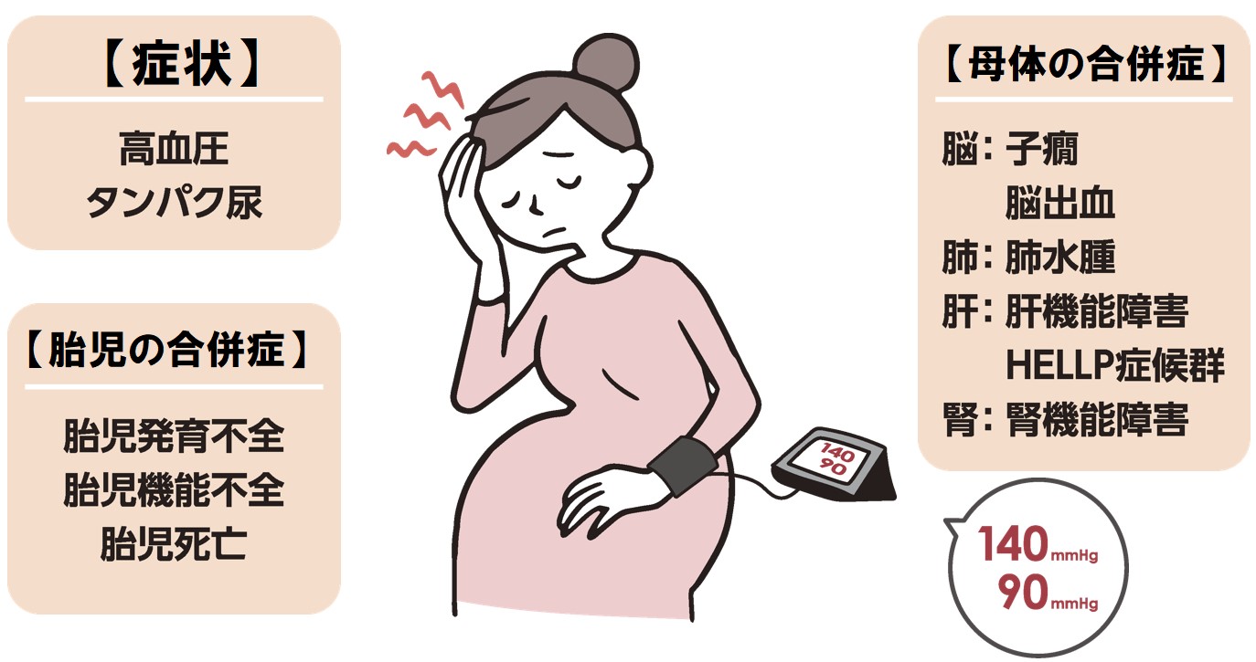 妊娠高血圧症候群で赤ちゃんに障害リスクは本当？後遺症の真相を徹底解説