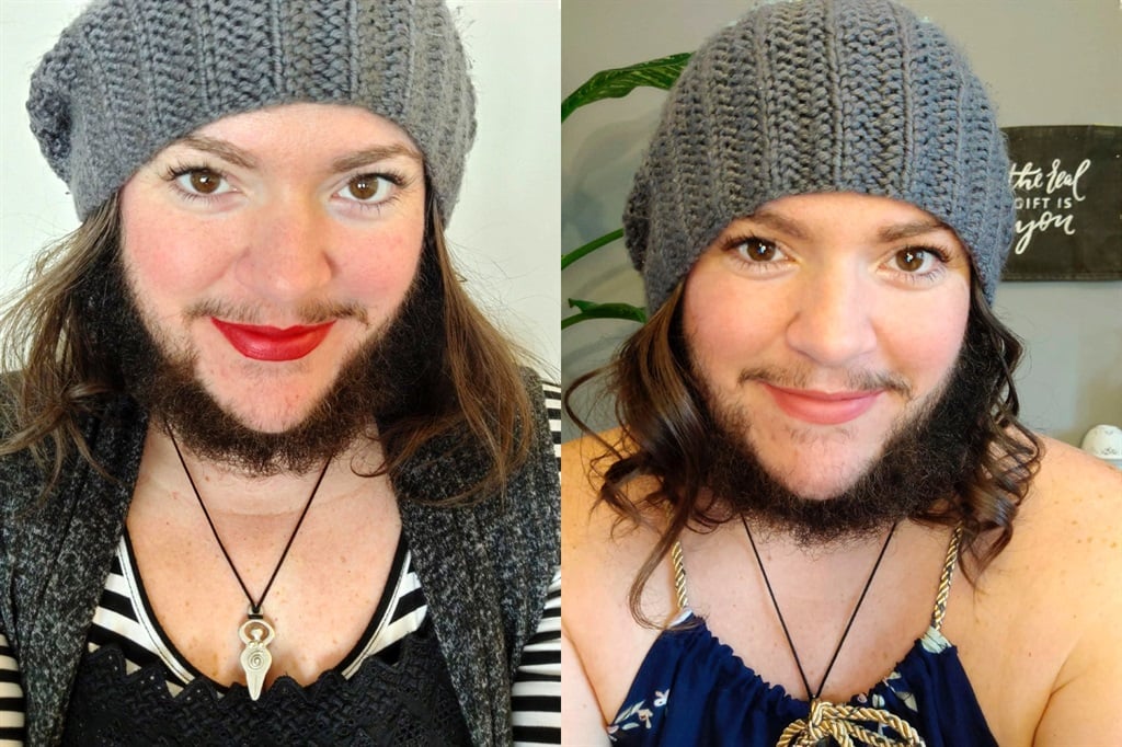 Can a Female Grow a Beard