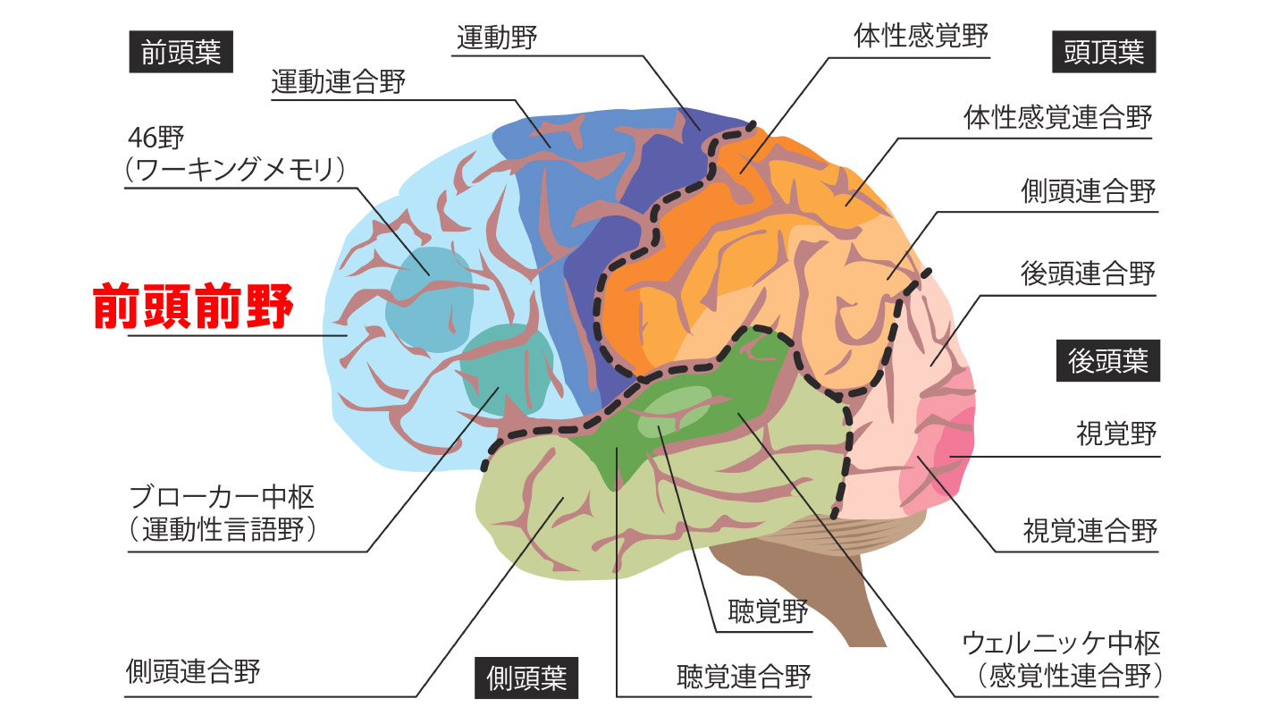 脳卒中と脳梗塞の違いとは？専門医が明かす包含関係と救命の前兆
