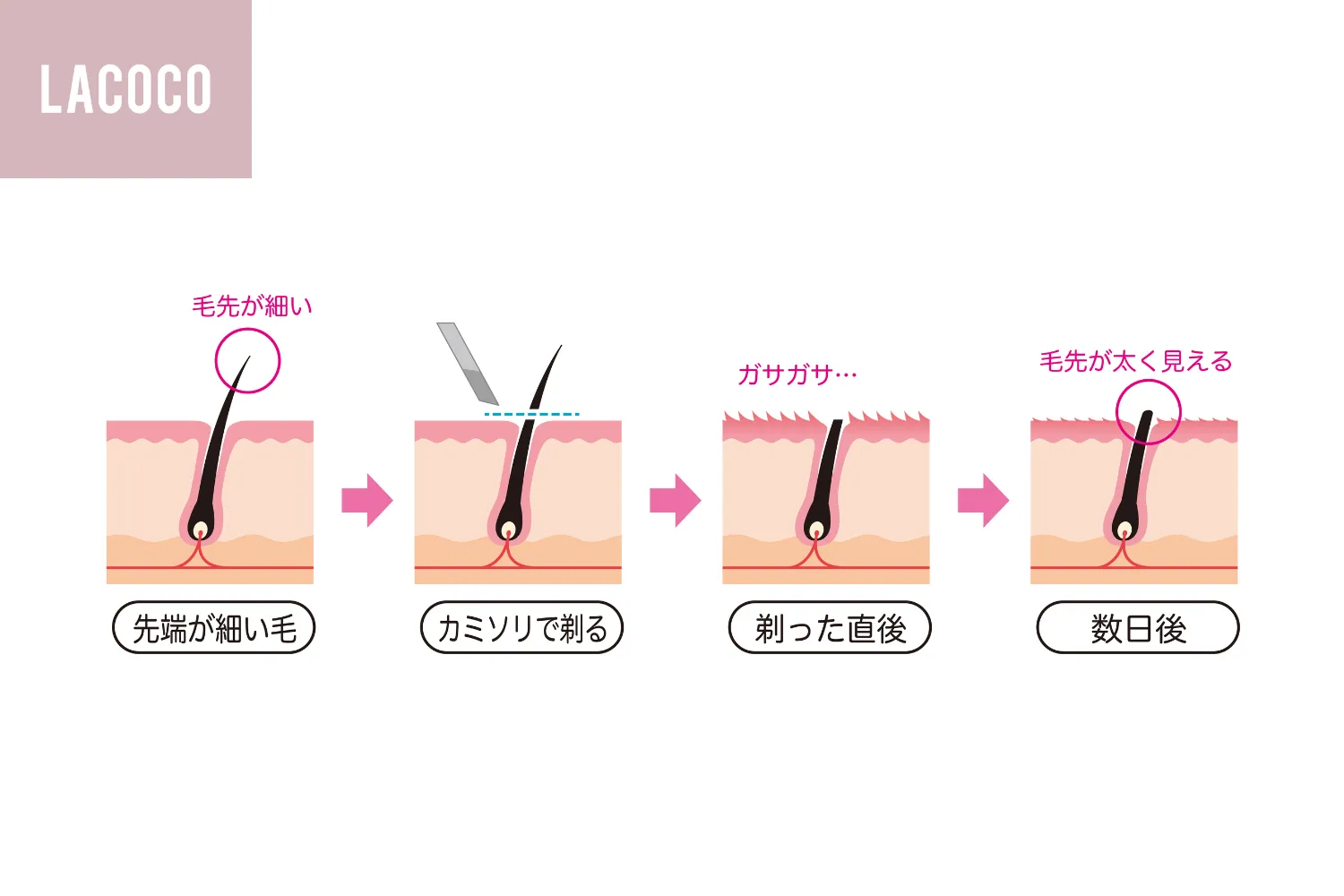 毛を剃ると濃くなる噂は嘘？皮膚科医が明かす真相と正しい剃り方