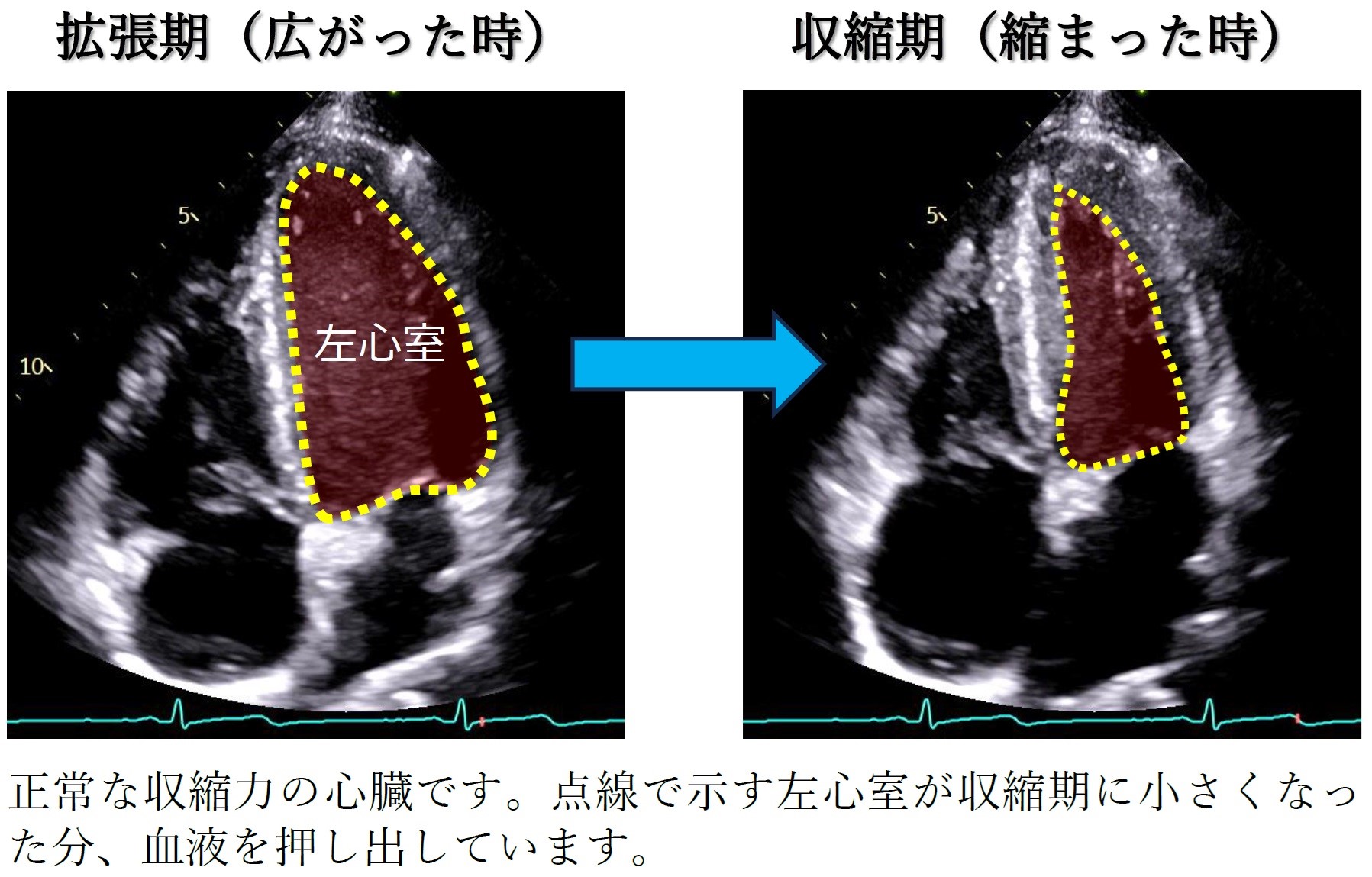 心エコーとは何がわかる検査？心電図との違いや費用・食事制限まで徹底解説