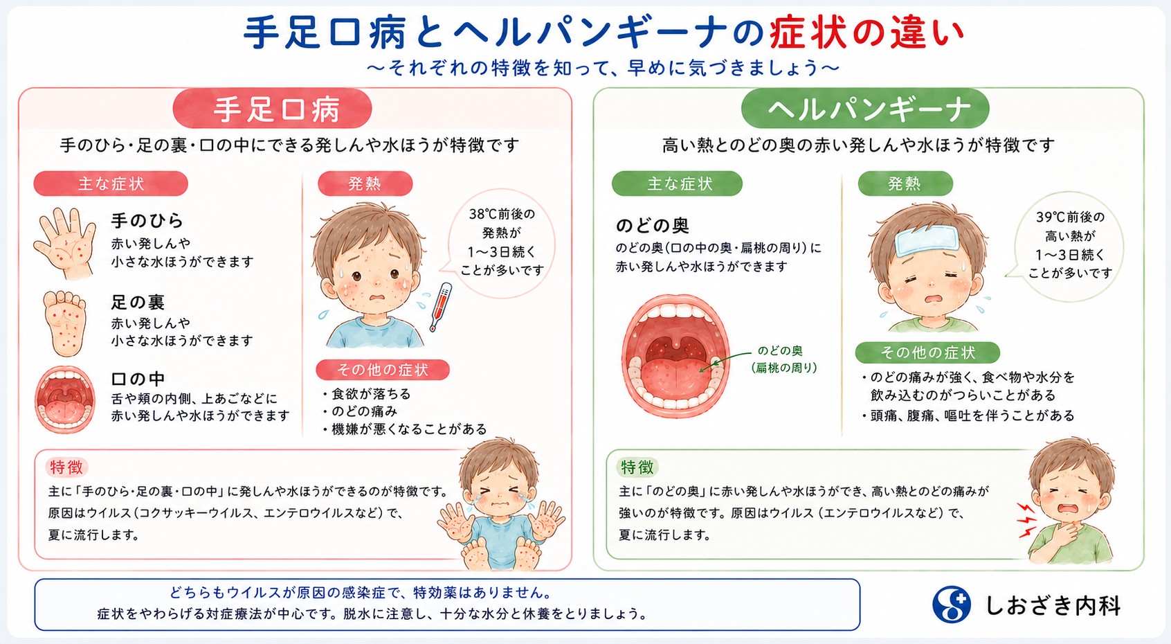 ヘルパンギーナと手足口病の違いは？発疹・熱の見分け方と登園基準【2026】