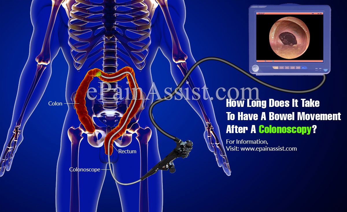 5 Days After Colonoscopy and No Bowel Movement