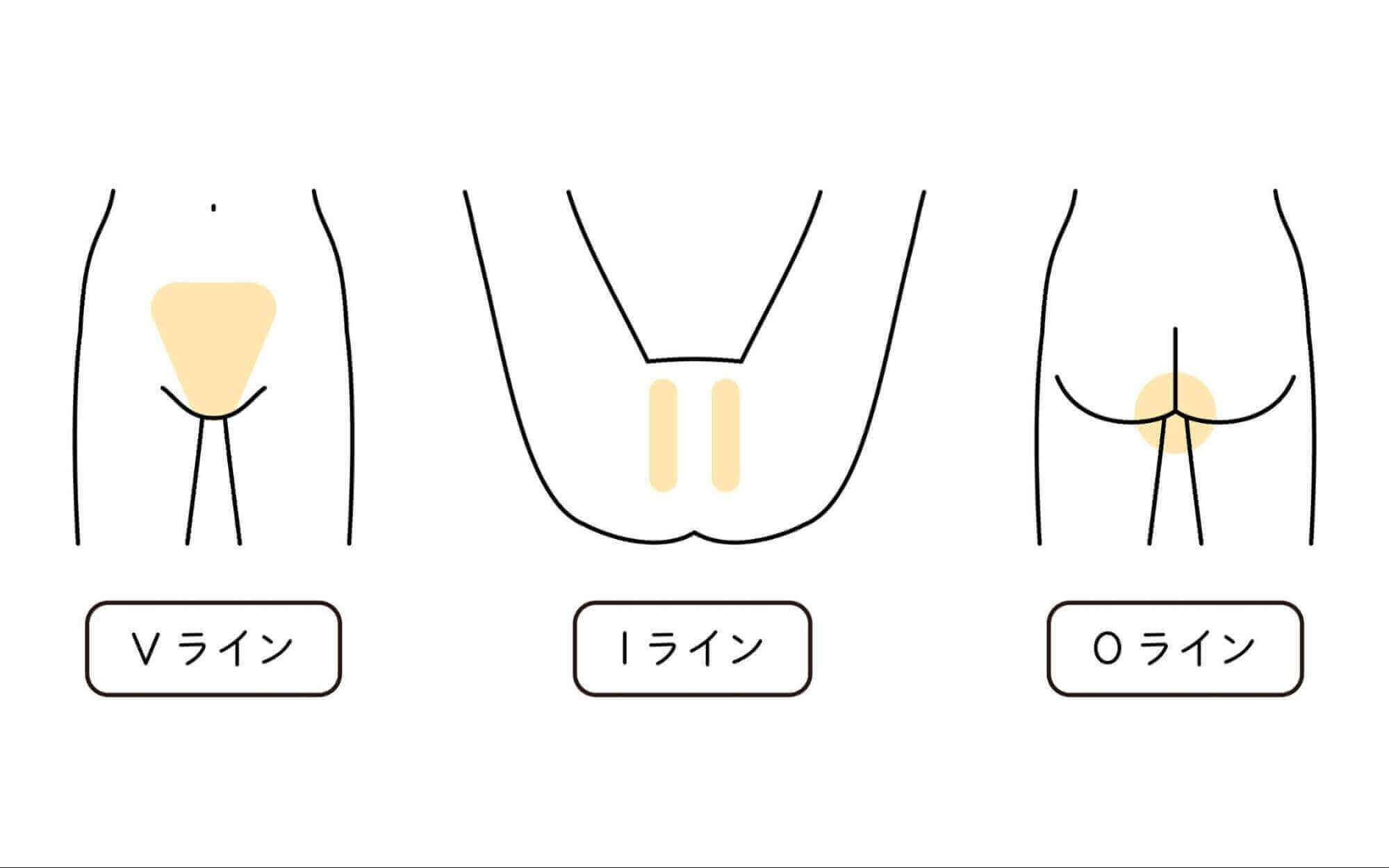 Vio自己処理の正しいやり方完全ガイド！チクチクやかゆみを防ぐプロ直伝術