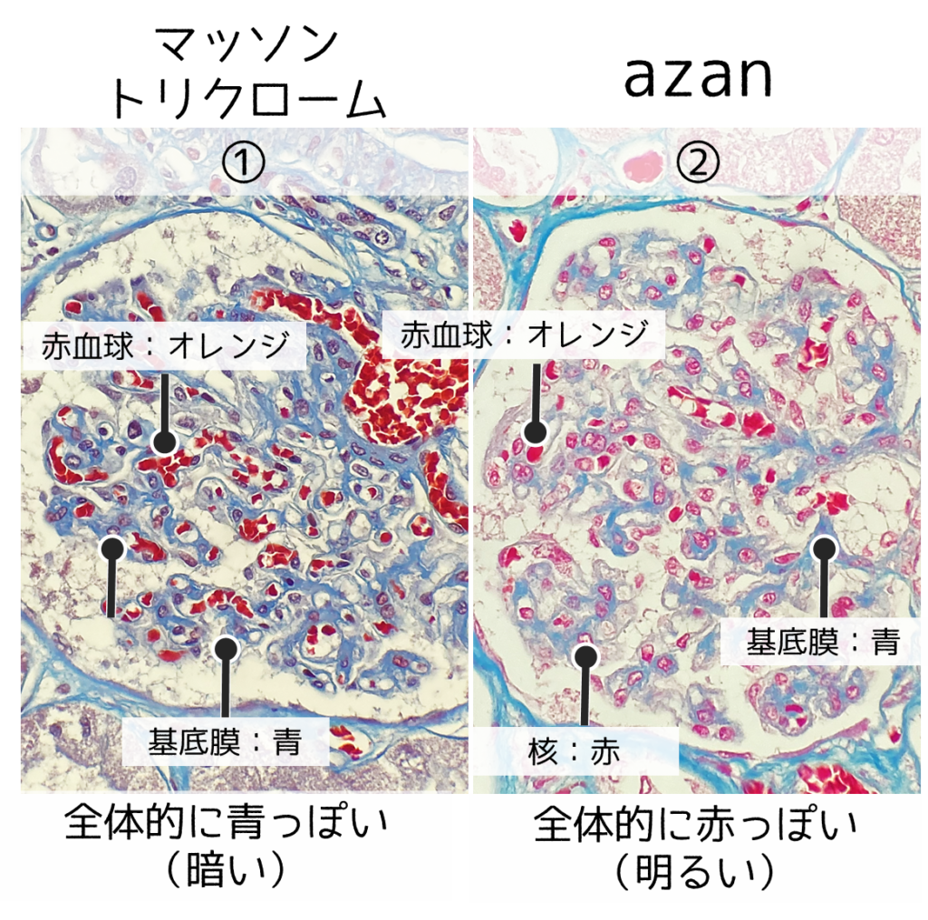 マッソントリクローム染色の原理と失敗原因を徹底解剖【2026最新】