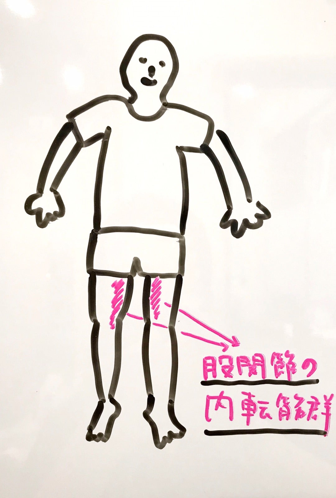 太もも内側がつる激痛の治し方！夜中のこむら返り原因と即効ストレッチ