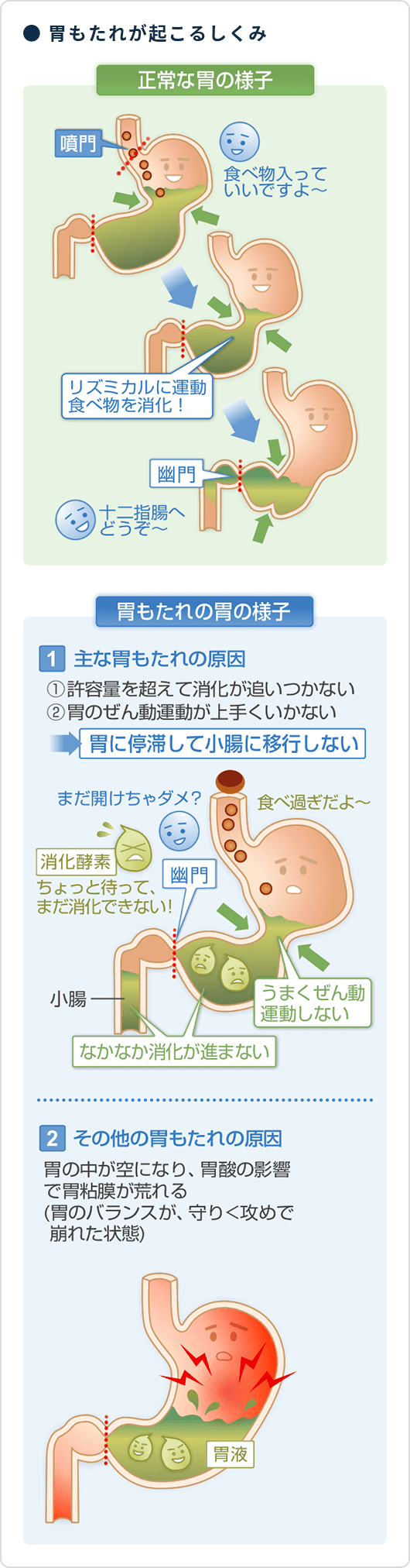 胃が重い原因はストレスだけじゃない？隠れた病気のサインと最新の対処法