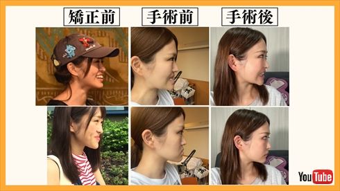 【インスタ画像】 顎 変形 症 芸能人 2026年最新プロフィール #615