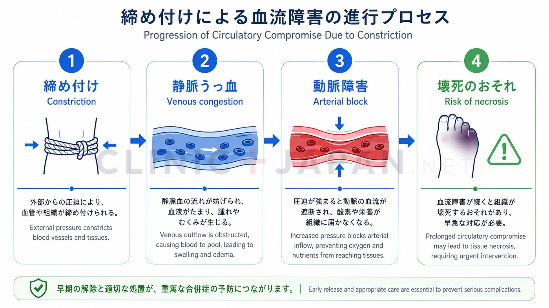 カントン包茎の原因と激痛の真相｜放置リスクと緊急時の正しい治し方